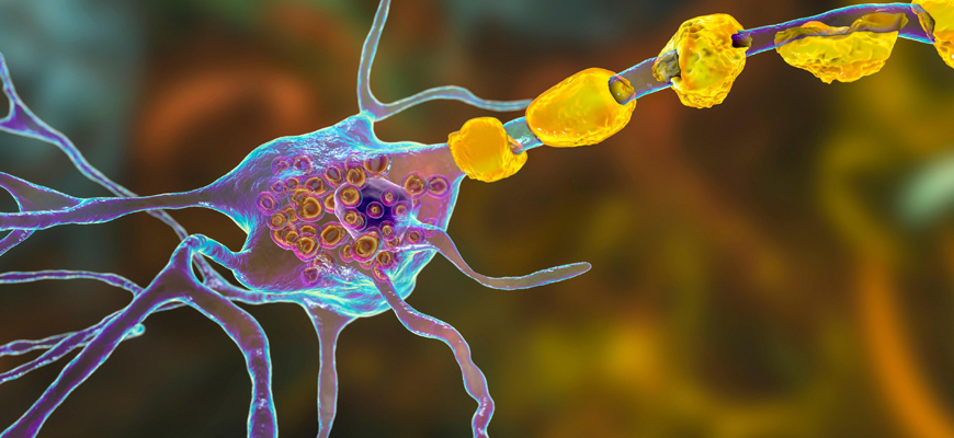 Treatment of Lipid Disorders
